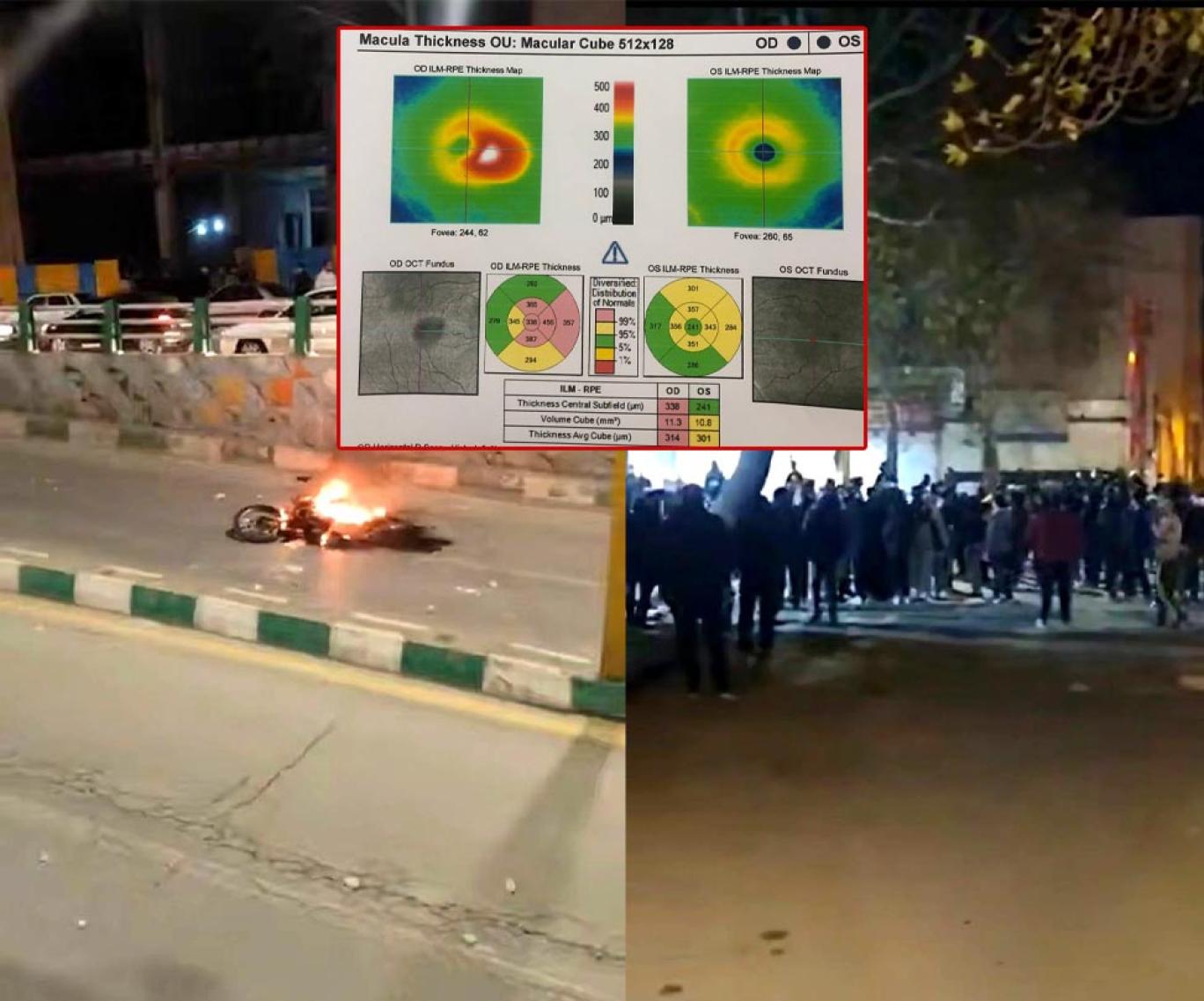 «بینایی‌ام دارد از بین می‌رود»؛ روایت شکنجه و نگهداری معترضان در کانکس در خرم‌آباد